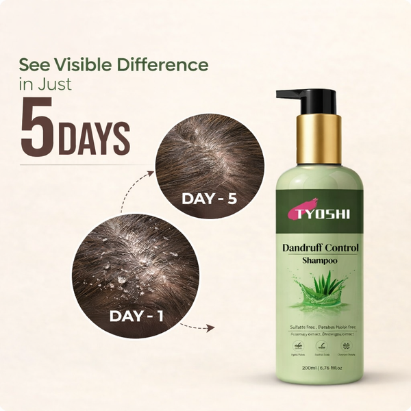 Dandruff Control Shampoo